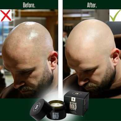 Програма догляду &laquo;Гоління налисо&raquo;